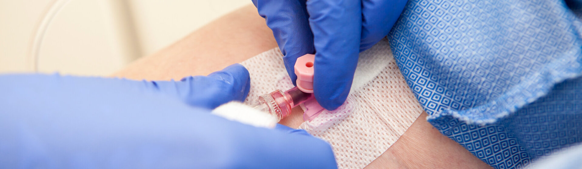 Hände mit blauen Latexhandschuhen legen einen Zugang am Arm für die Infusionstherapie