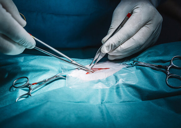 Behandlungsschwerpunkt Narbenkorrektur