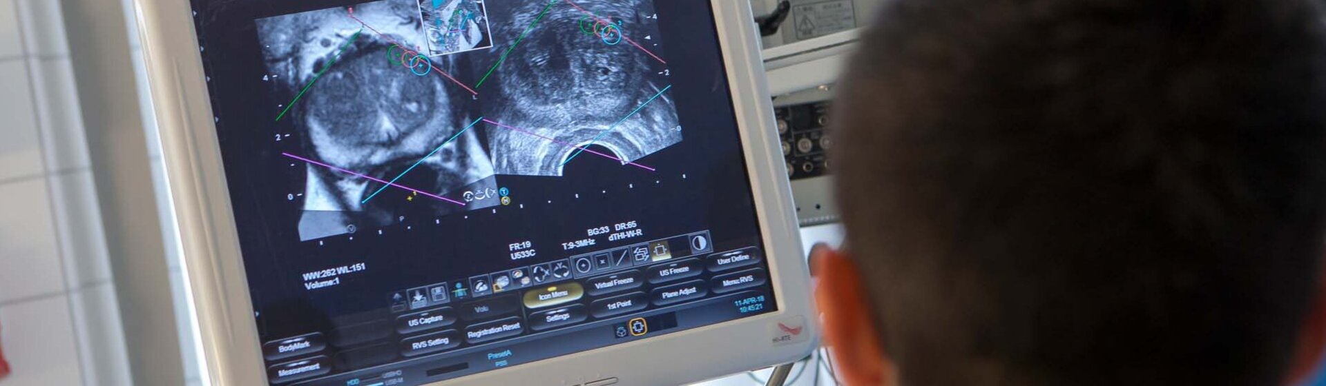 Mediziner schaut Ultraschallbild an