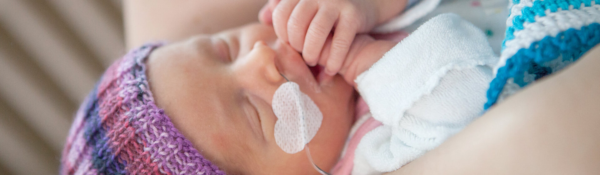 Ein Frühgeborenes mit Beatmungsschlauch in der Nase. Ein Frühgeborenes mit Beatmungsschlauch in der Nase.