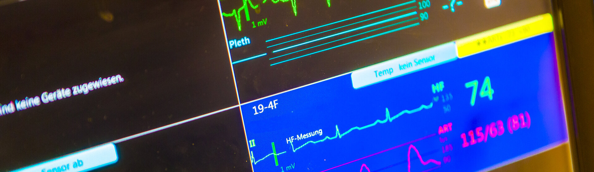 Überwachungsmonitor Überwachungsmonitor