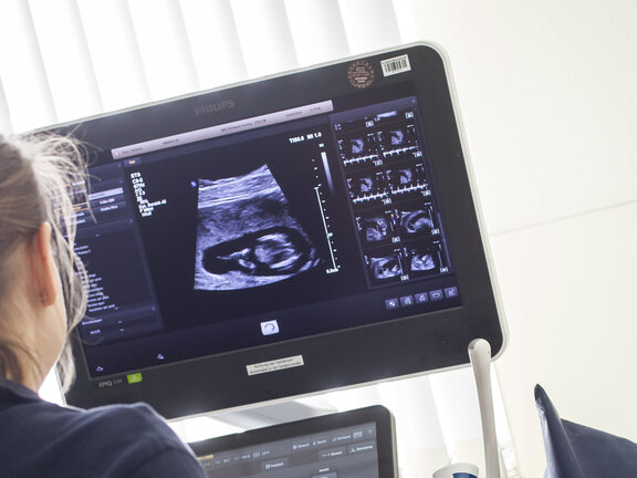 Ultraschalluntersuchung einer Schwangeren