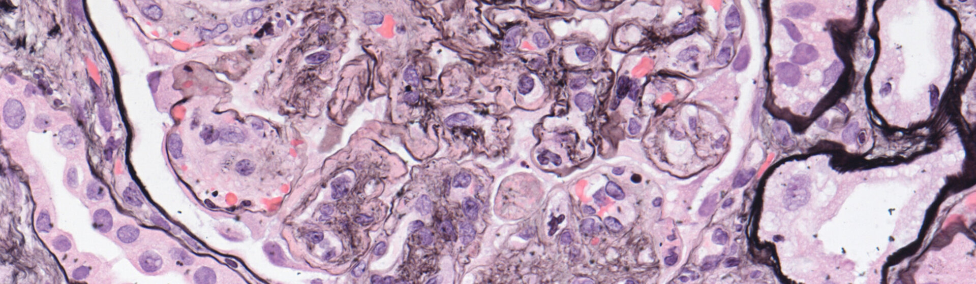 Ein lichtmikroskopisches Bild eines Nierenkörperchens, es stellt die kleinste funktionelle Filtrationseinheit der Niere dar. Ein lichtmikroskopisches Bild eines Nierenkörperchens, es stellt die kleinste funktionelle Filtrationseinheit der Niere dar.