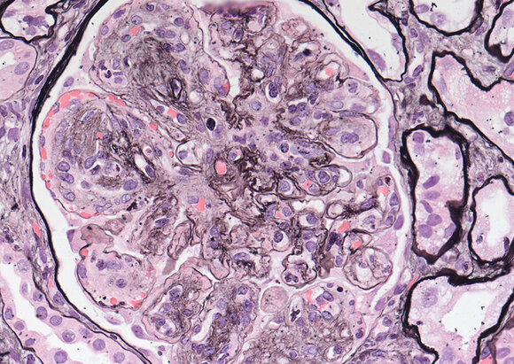 Behandlungsschwerpunkt Nephrologie