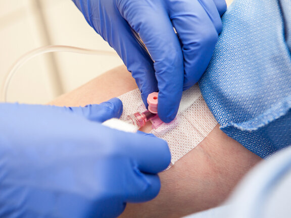 Hände mit blauen Latexhandschuhen legen einen Zugang am Arm für die Infusionstherapie.