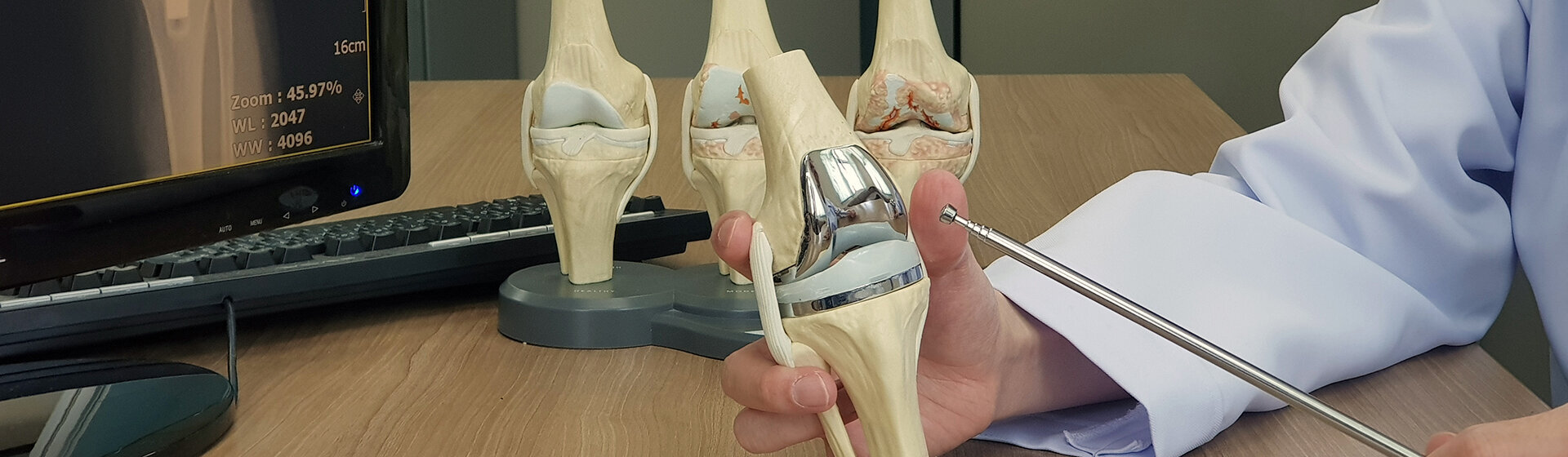 Mediziner hält ein Modell vom Kniegelenk in der Hand. Mediziner hält ein Modell vom Kniegelenk in der Hand.