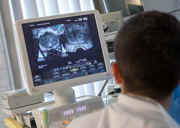 Behandlungsschwerpunkt Prostatakrebs