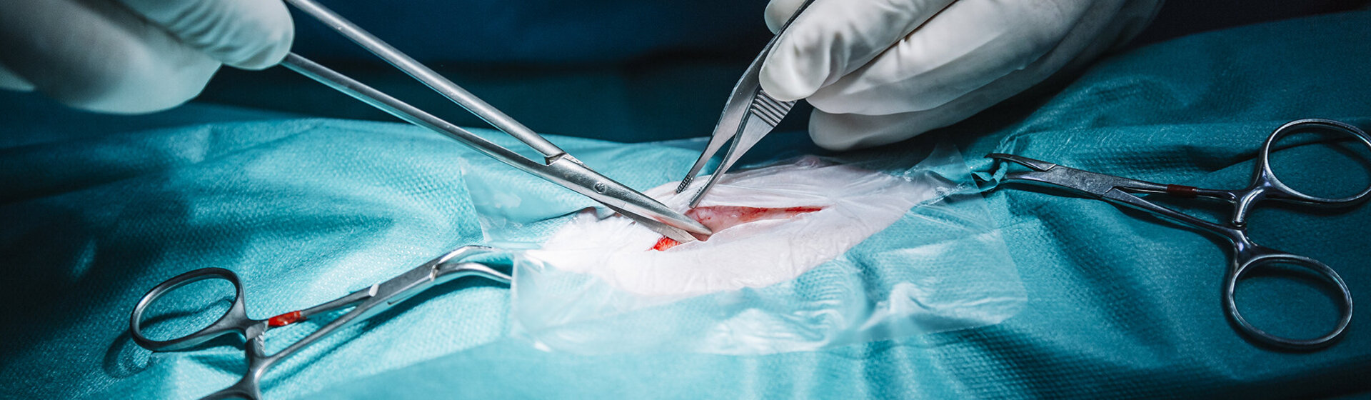 Narbenkorrektur im Operationssaal.