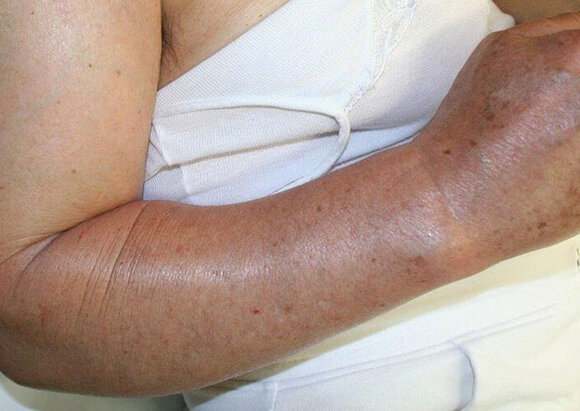 Behandlungsschwerpunkt Infektbehandlung Behandlungsschwerpunkt Infektbehandlung