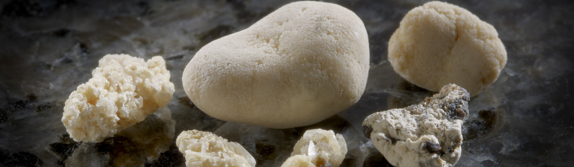 Sechs Harnsteine in verschiedenen Größen