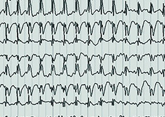 Leistungen der Spezialsprechstunde für Epilepsie Leistungen der Spezialsprechstunde für Epilepsie