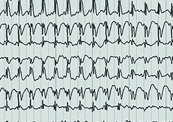 Behandlungsschwerpunkt Epilepsie Behandlungsschwerpunkt Epilepsie