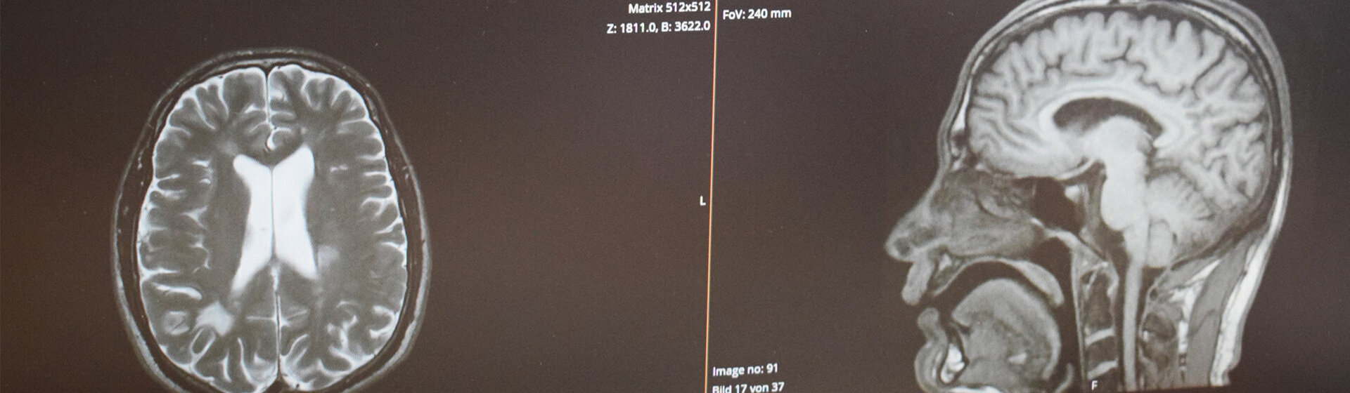 Röntgenbild vom Kopf (Ansichten von oben und von der Seite) Röntgenbild vom Kopf (Ansichten von oben und von der Seite)